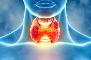 throat cancer hospital