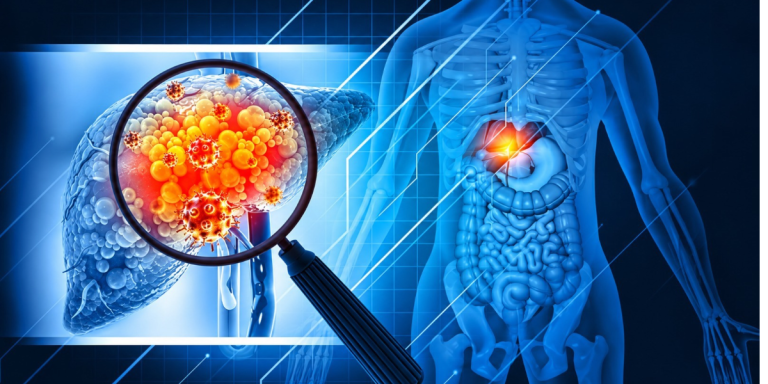 Cancer Treatment in Tamil Nadu